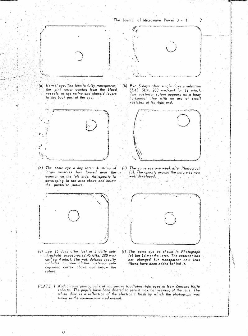 AI-described figure: Plate 1: Kodachrome photographs showing changes in microwave-irradiated rabbit eyes over time.