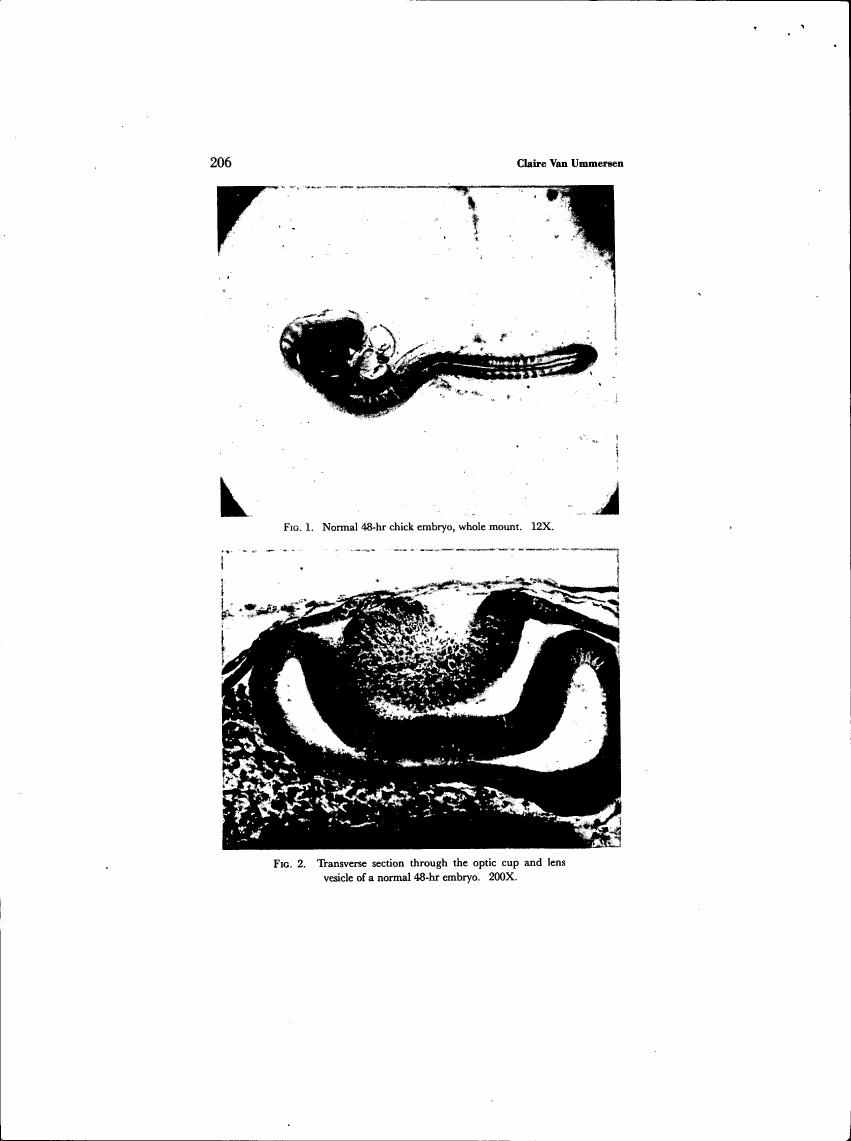 AI-described figure: Fig. 1: Normal 48-hr chick embryo, whole mount; Fig. 2: Transverse section through the optic cup and lens vesicle of a normal 48-hr embryo.