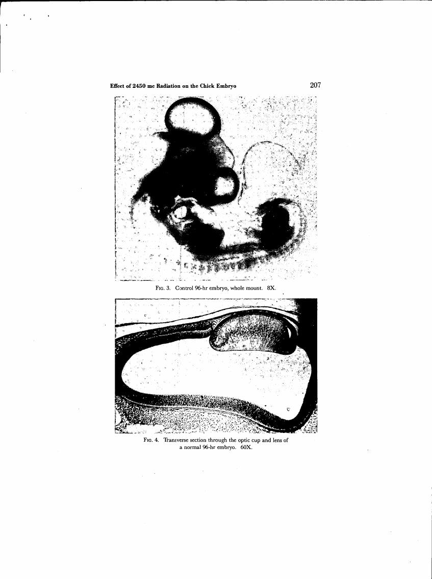 AI-described figure: Fig. 3 and Fig. 4 show a control 96-hr embryo whole mount at 8X magnification and a transverse section through the optic cup and lens of a normal 96-hr embryo at 60X magnification, respectively.