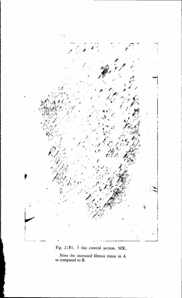AI-described figure: Fig. 2(B). 5 day control section. 50X. Note the increased fibrous tissue in A as compared to B.