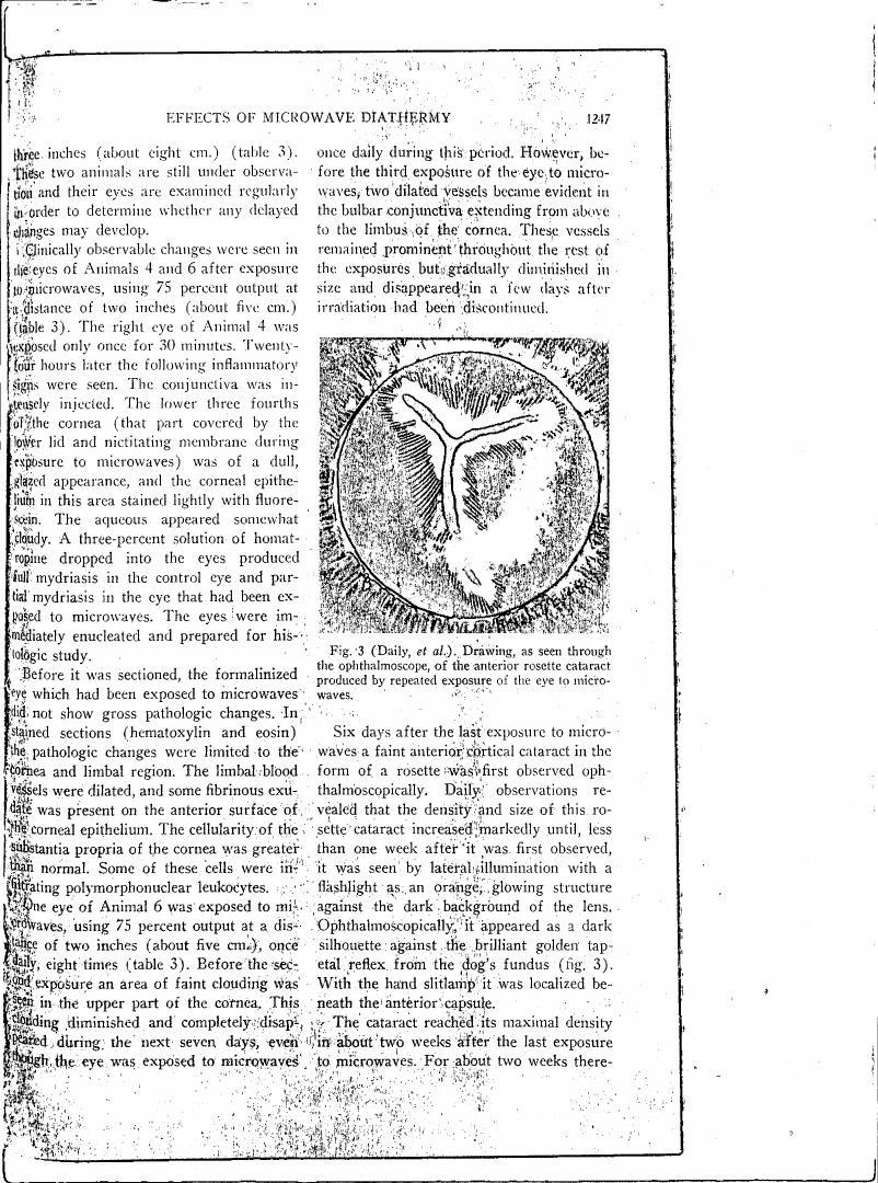 Figure 3 depicts a drawing as seen through an ophthalmoscope of the anterior rosette cataract produced by repeated exposure of the eye to microwaves.