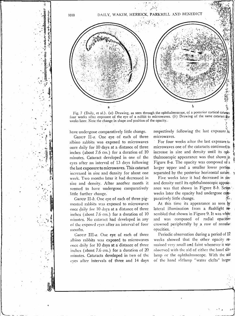 Fig. 7 (Daily, et al.). (a) Drawing, as seen through the ophthalmoscope, of a posterior cortical cataract four weeks after exposure of the eye of a rabbit to microwaves. (b) Drawing of the same cataract five weeks later.