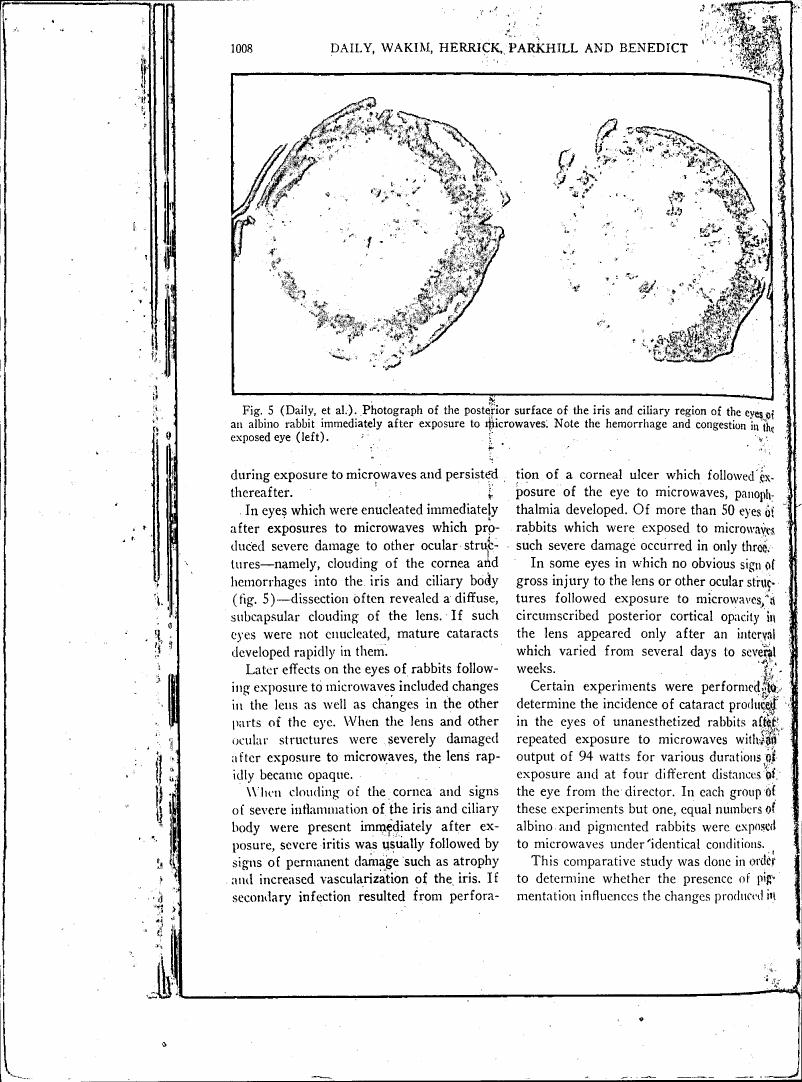 Figure 5 (Daily et al.) Photograph of the posterior surface of the iris and ciliary region of the eye of an albino rabbit immediately after exposure to microwaves. Note the hemorrhage and congestion in the exposed eye (left).