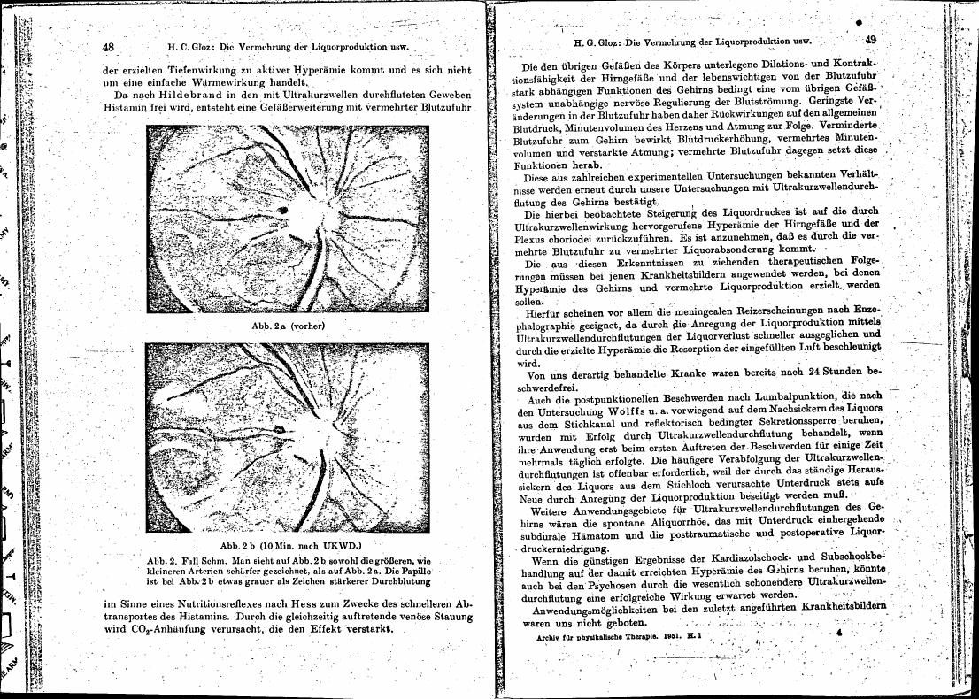 AI-described figure: A diagram showing a comparison between two states (Abb.2a and Abb.2b) with annotations about blood flow changes in response to ultrashort wave treatment.