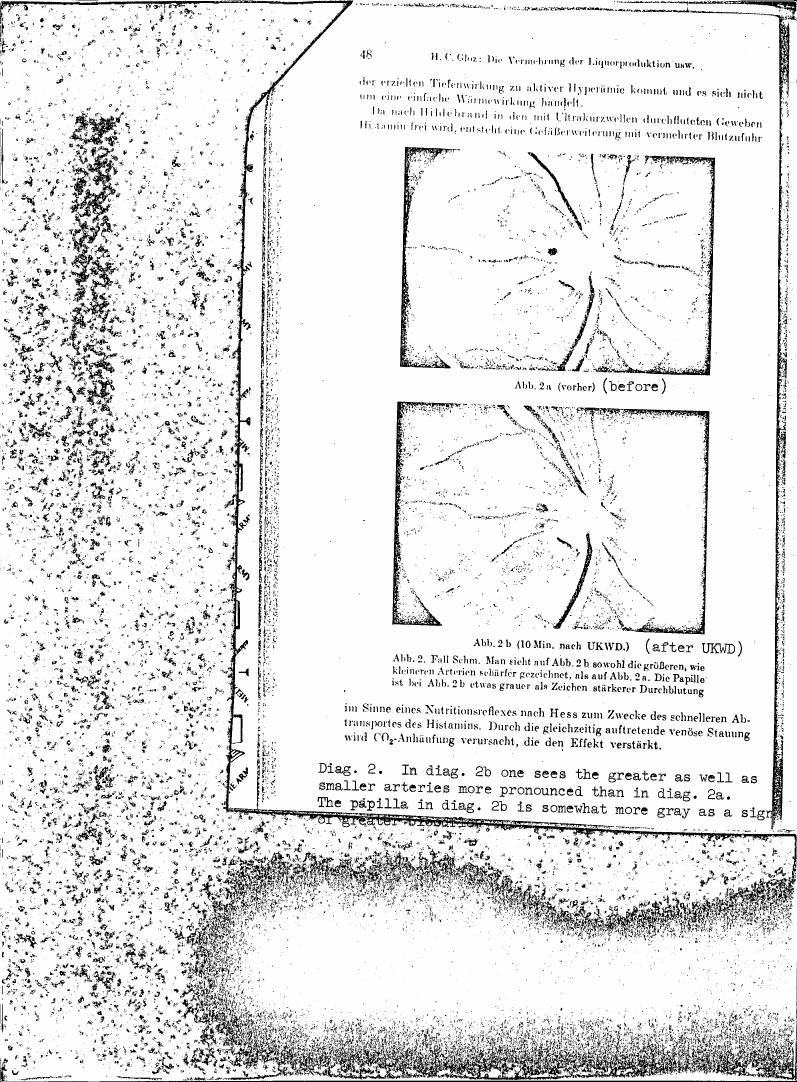 AI-described figure: A diagram showing blood vessel dilation and increased blood flow before (2a) and after (2b) ultrashort wave diathermy treatment.