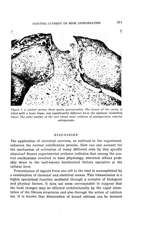 AI-described figure: Figure 7. A control section three weeks postoperative showing the lumen of the cavity filled with loose tissue and some evidence of postoperative reactive osteogenesis.