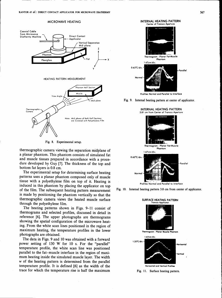 AI-described figure: Experimental setup and heating pattern measurements for microwave diathermy using a phantom model.