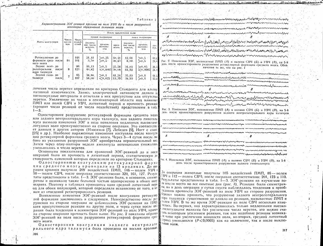 AI-described figure: Electroencephalogram (EEG) changes in response to various stimuli and brain lesions on day 5 after right-sided reticular formation of the midbrain or posterior ventrolateral nucleus of the thalamus lesioning, as shown in Figures 2-4.
