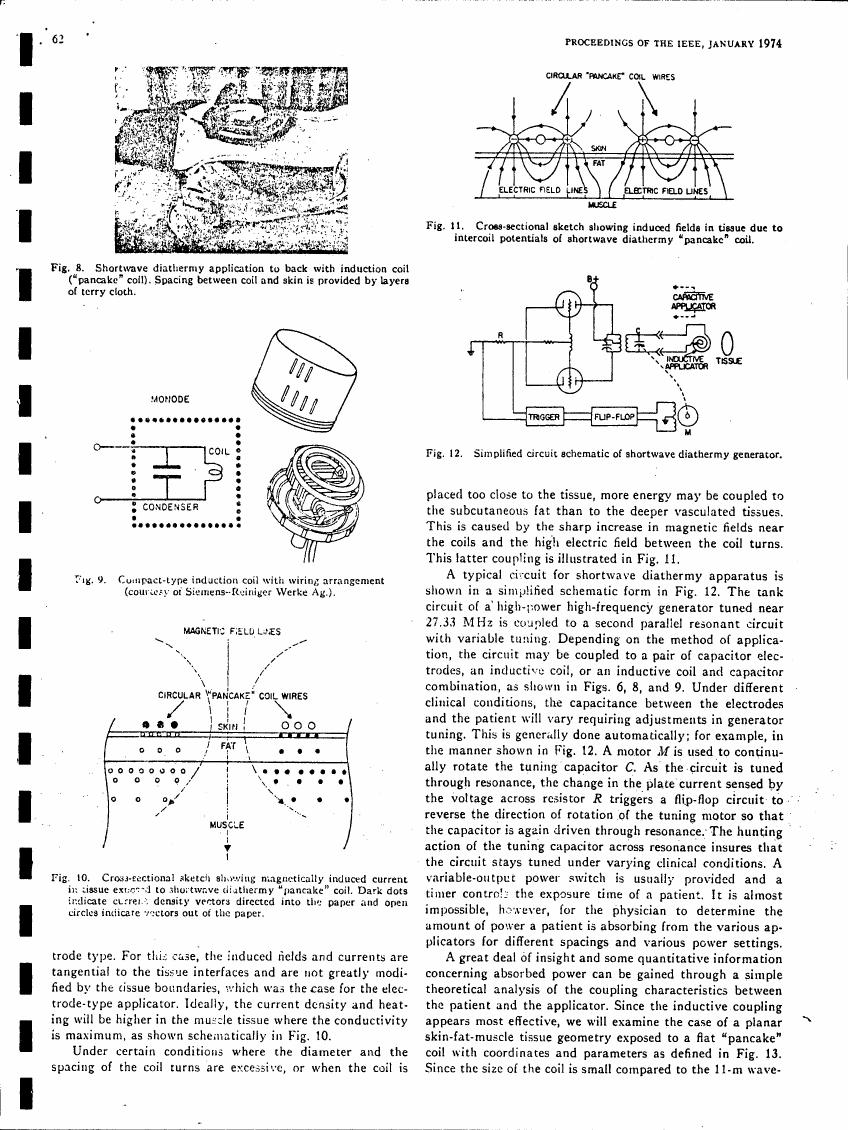 AI-described figure: Fig. 10: Cross-sectional sketch showing magnetically induced current in tissue external to shortwave diathermy 'pancake' coil.
