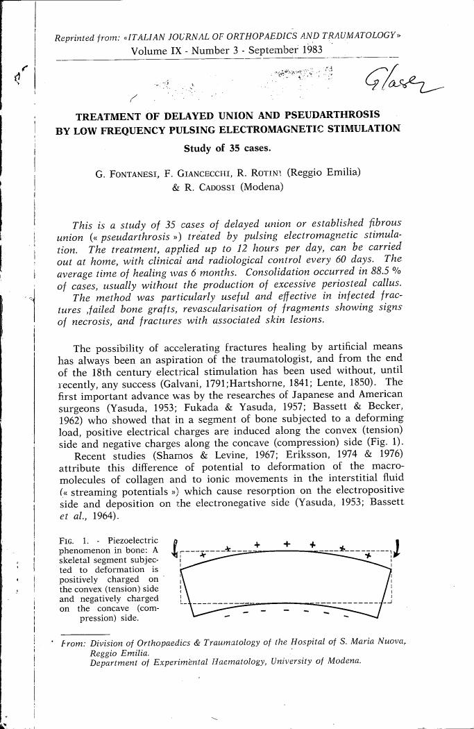 Figure 1. Piezoelectric phenomenon in bone: A skeletal segment subjected to deformation is positively charged on the convex (tension) side and negatively charged on the concave (compression) side.