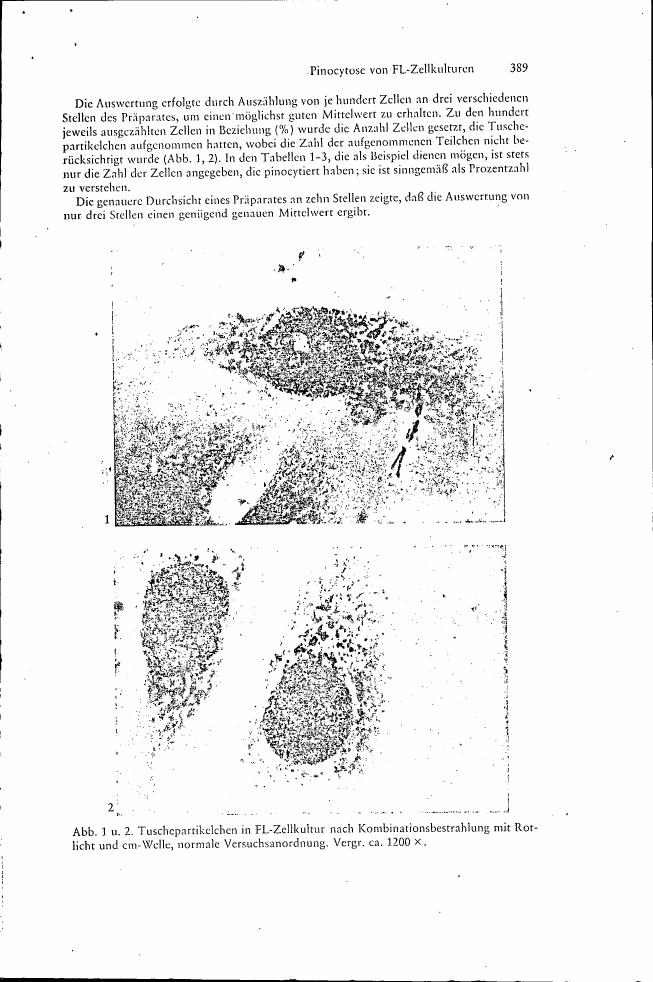 AI-described figure: Tusche particles in FL cell cultures after combined irradiation with red light and cm waves, normal experimental arrangement. Magnified approximately 1200x.