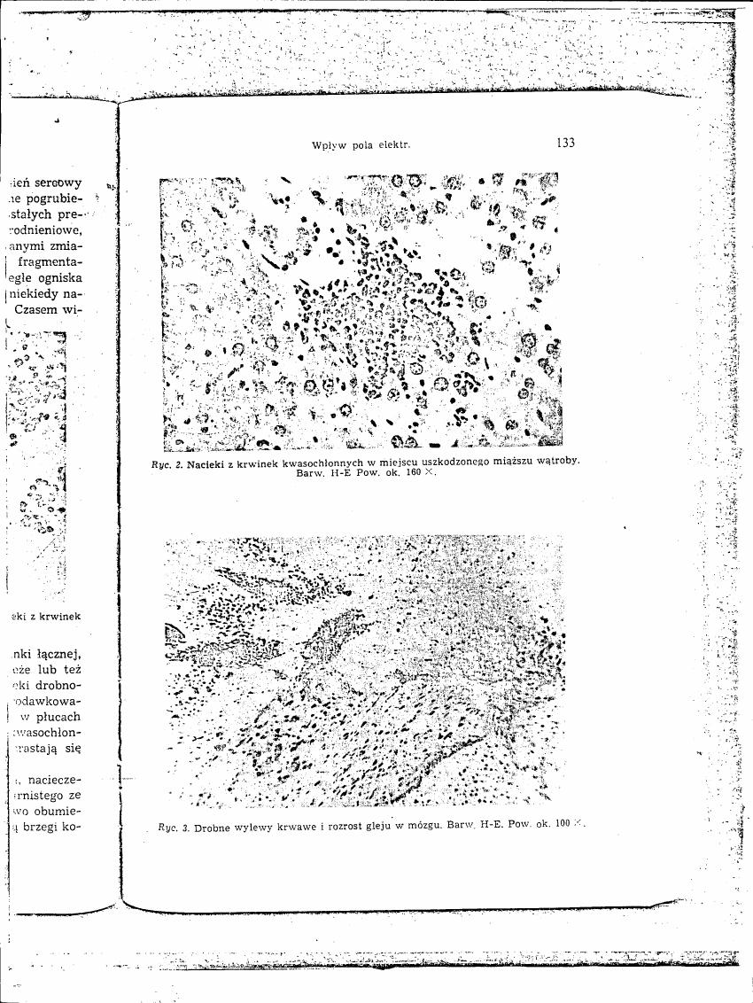 AI-described figure: Figure 2: Nuclei from acidic blood cells in a damaged liver muscle tissue. Barw. H-E Pow. ok. 160 X.